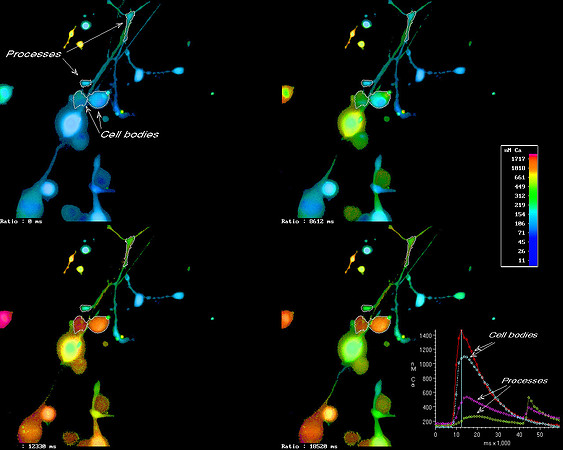 Intracellular calcium ion dynamics